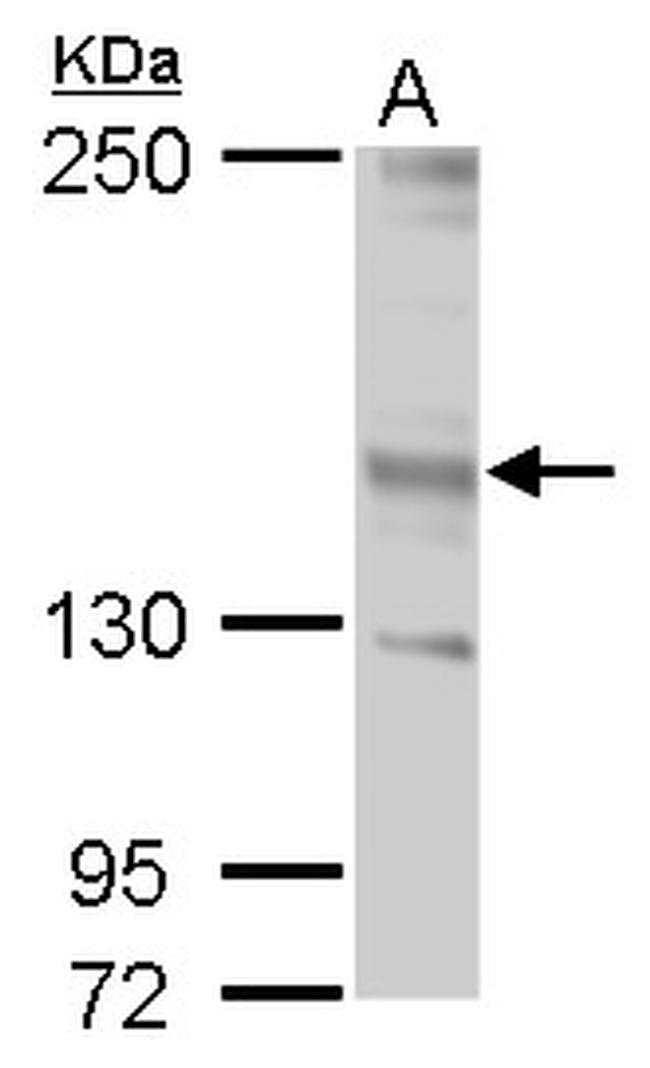 JARID2 Antibody in Western Blot (WB)