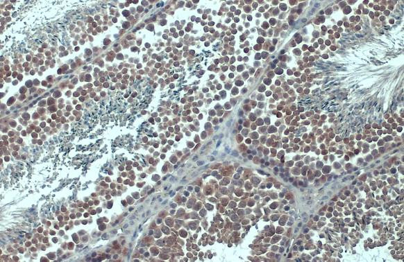 KPNB1 Antibody in Immunohistochemistry (Paraffin) (IHC (P))