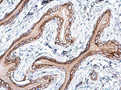 Pan Ras Antibody in Immunohistochemistry (Paraffin) (IHC (P))