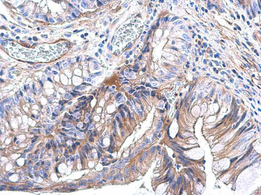 Pan Ras Antibody in Immunohistochemistry (Paraffin) (IHC (P))