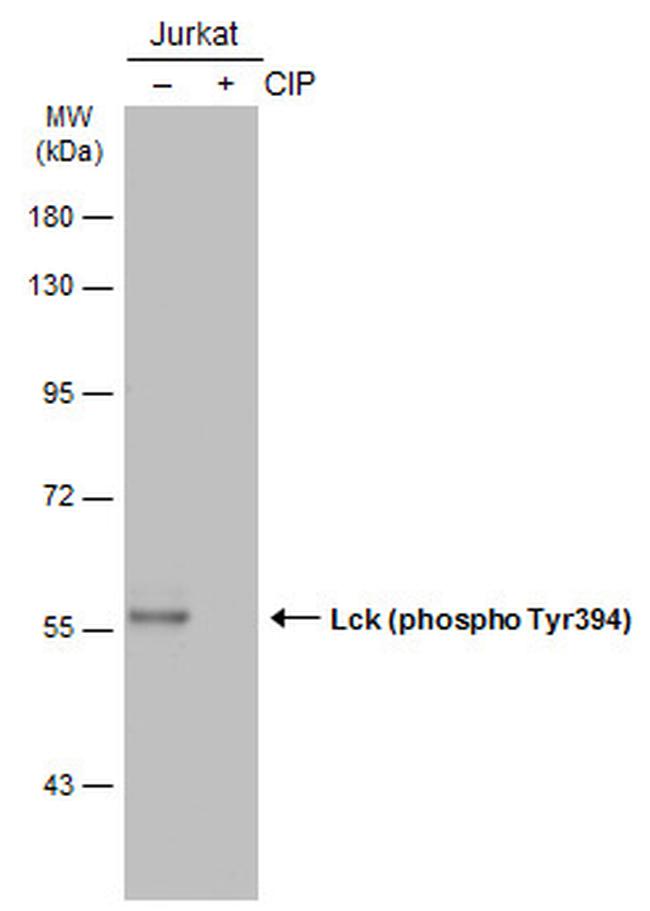 Phospho-LCK (Tyr394) Antibody in Western Blot (WB)