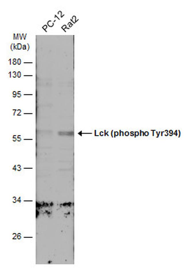 Phospho-LCK (Tyr394) Antibody in Western Blot (WB)