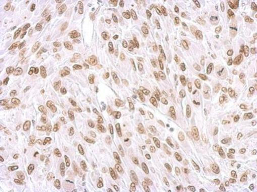 Lamin A/C Antibody in Immunohistochemistry (Paraffin) (IHC (P))