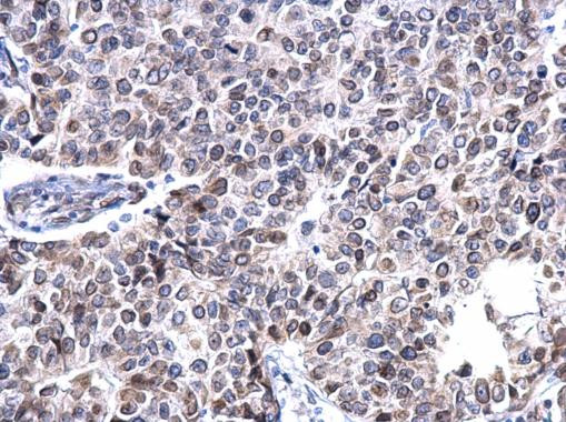 Lamin A/C Antibody in Immunohistochemistry (Paraffin) (IHC (P))