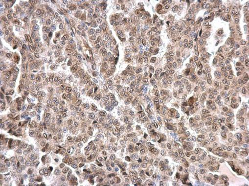 Lamin A/C Antibody in Immunohistochemistry (Paraffin) (IHC (P))