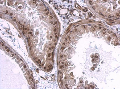 Lamin A/C Antibody in Immunohistochemistry (Paraffin) (IHC (P))