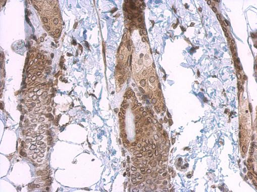 Lamin A/C Antibody in Immunohistochemistry (Paraffin) (IHC (P))