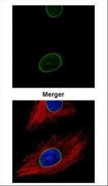 Lamin A/C Antibody in Immunocytochemistry (ICC/IF)