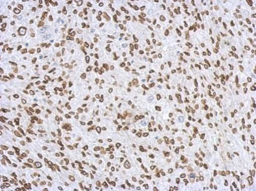 Lamin A/C Antibody in Immunohistochemistry (Paraffin) (IHC (P))