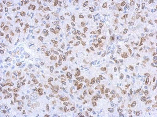 Lamin A/C Antibody in Immunohistochemistry (Paraffin) (IHC (P))