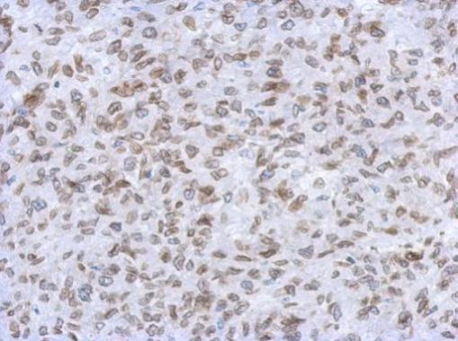 Lamin A/C Antibody in Immunohistochemistry (Paraffin) (IHC (P))