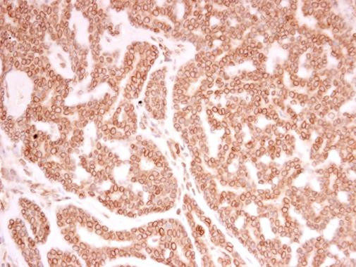 Lamin A/C Antibody in Immunohistochemistry (Paraffin) (IHC (P))