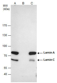 Lamin A/C Antibody in Immunoprecipitation (IP)