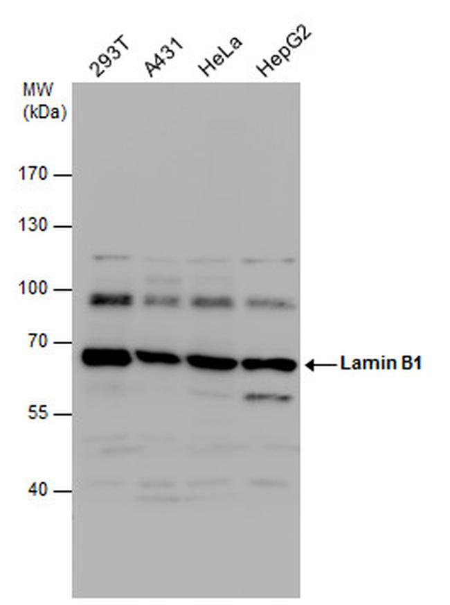 Lamin B1 Antibody in Western Blot (WB)