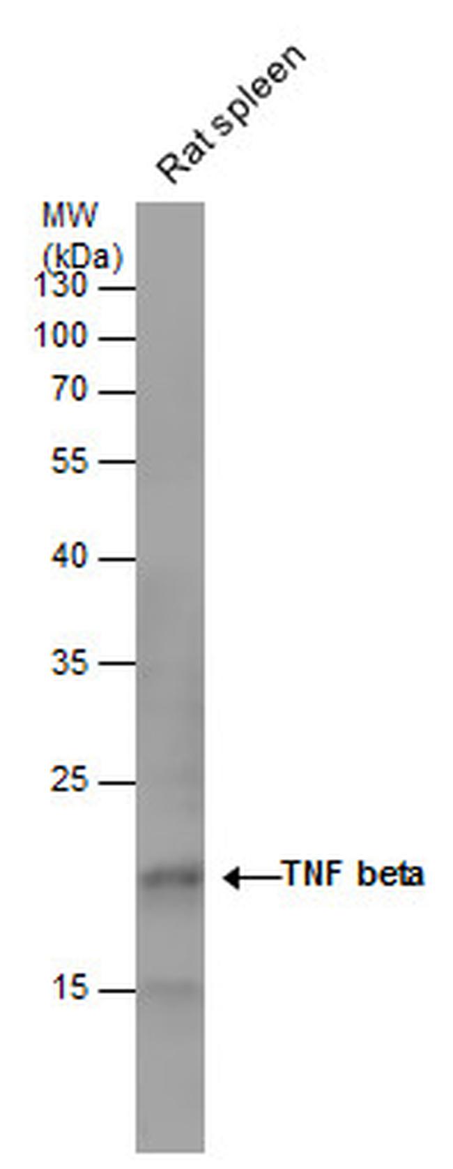 TNF beta Antibody in Western Blot (WB)