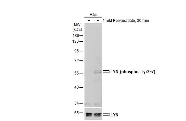 Phospho-Lyn (Tyr396) Antibody in Western Blot (WB)