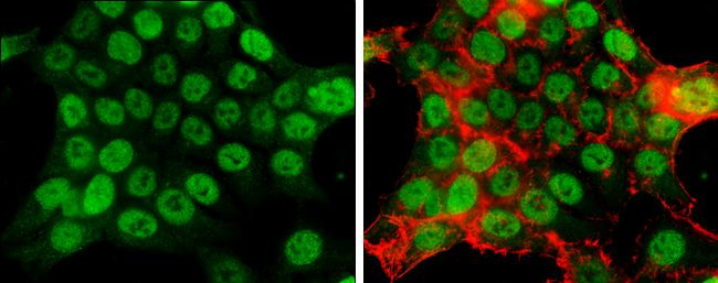 MCM2 Antibody in Immunocytochemistry (ICC/IF)