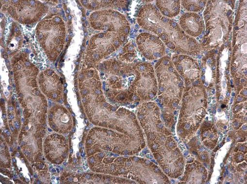 MEKK3 Antibody in Immunohistochemistry (Paraffin) (IHC (P))