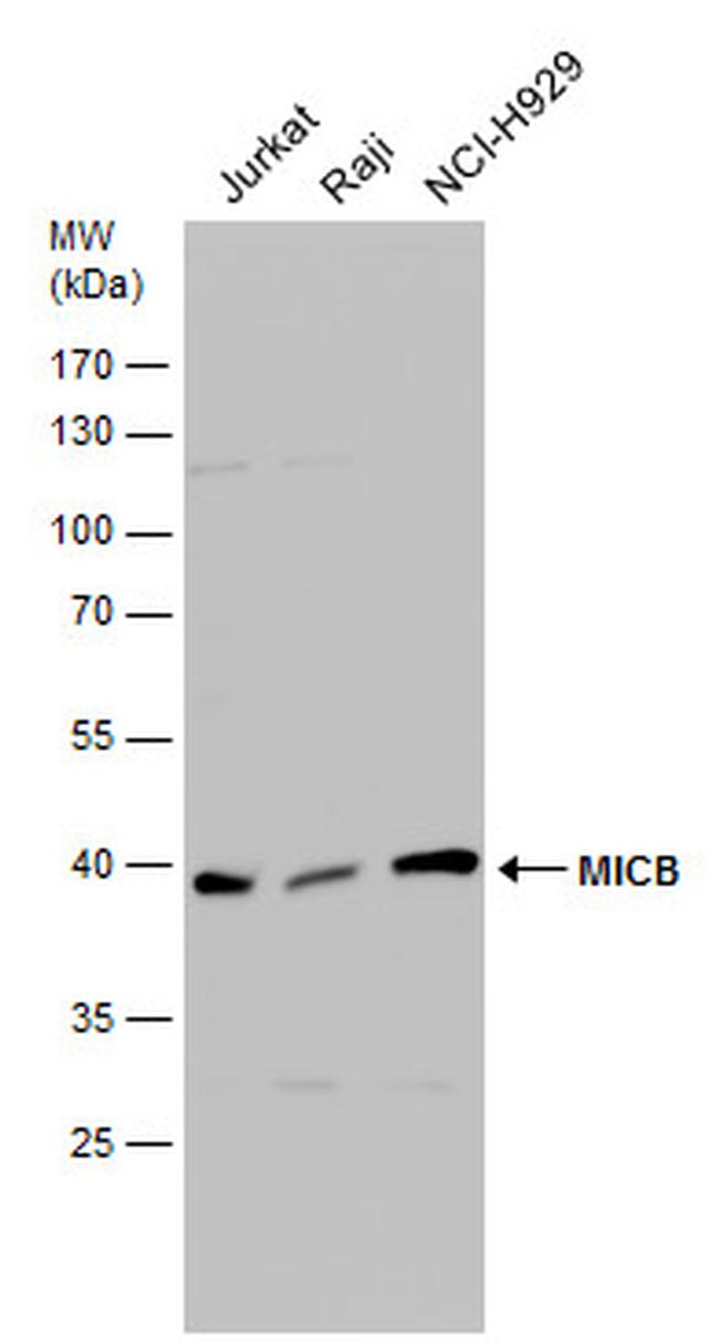 MICB Antibody in Western Blot (WB)