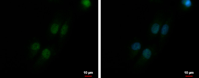 MRE11 Antibody in Immunocytochemistry (ICC/IF)