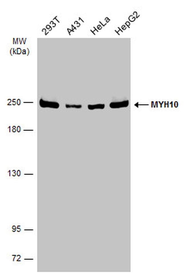 MYH10 Antibody in Western Blot (WB)