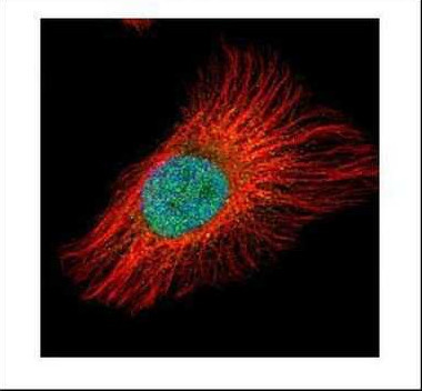 IkB beta Antibody in Immunocytochemistry (ICC/IF)