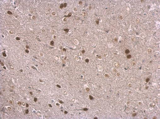 NPAS1 Antibody in Immunohistochemistry (Paraffin) (IHC (P))