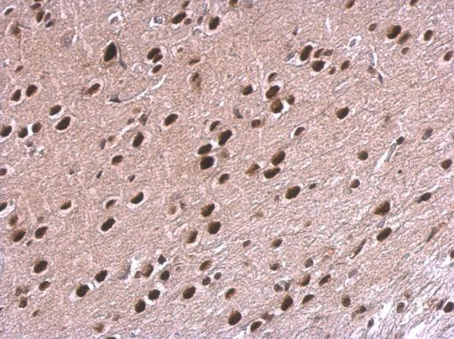 NPAS1 Antibody in Immunohistochemistry (Paraffin) (IHC (P))