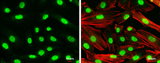 Nurr1 Antibody in Immunocytochemistry (ICC/IF)