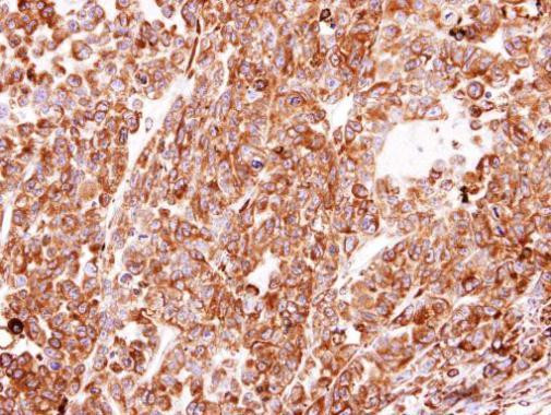 PDI Antibody in Immunohistochemistry (Paraffin) (IHC (P))