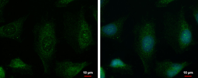 PHKA1 Antibody in Immunocytochemistry (ICC/IF)