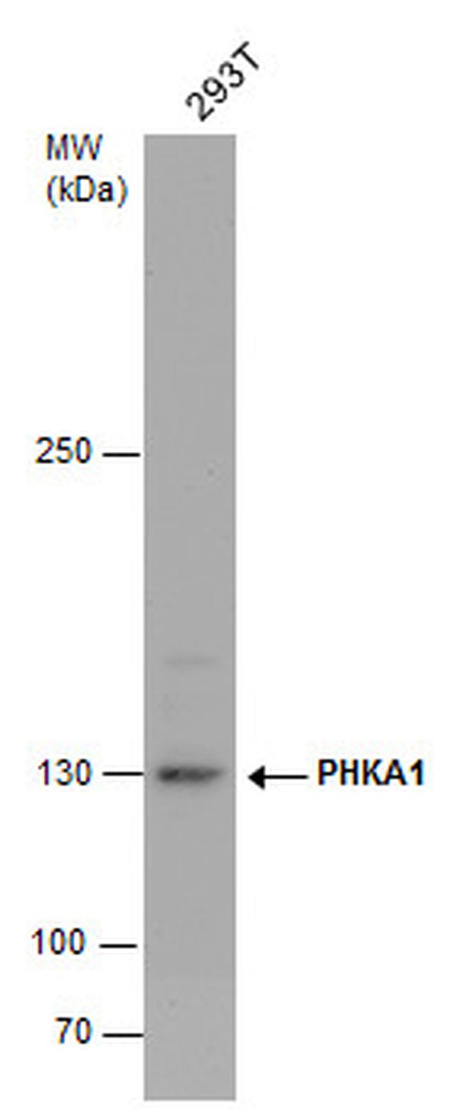 PHKA1 Antibody in Western Blot (WB)