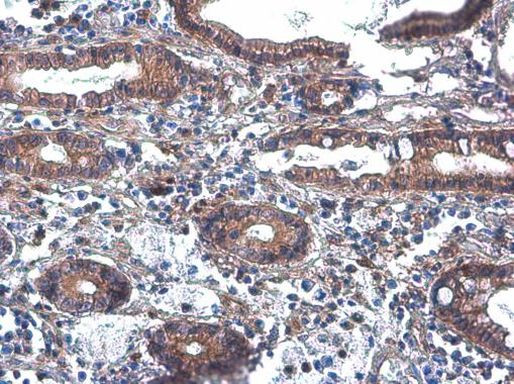 PLCB2 Antibody in Immunohistochemistry (Paraffin) (IHC (P))