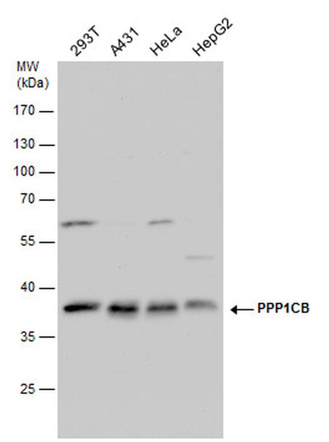 PP1 beta Antibody in Western Blot (WB)