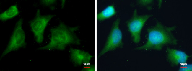 PRKAR2A Antibody in Immunocytochemistry (ICC/IF)