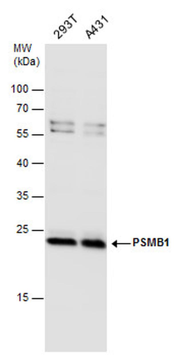 PSMB1 Antibody in Western Blot (WB)