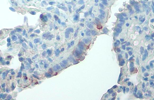 Phospho-FAK (Tyr576) Antibody in Immunohistochemistry (Paraffin) (IHC (P))