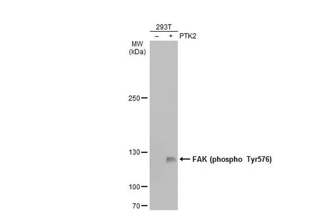 Phospho-FAK (Tyr576) Antibody in Western Blot (WB)