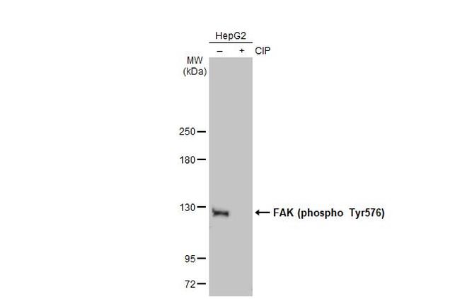 Phospho-FAK (Tyr576) Antibody in Western Blot (WB)