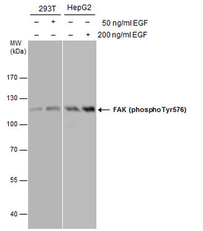Phospho-FAK (Tyr576) Antibody in Western Blot (WB)