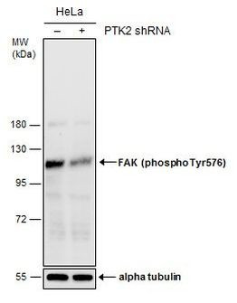 Phospho-FAK (Tyr576) Antibody