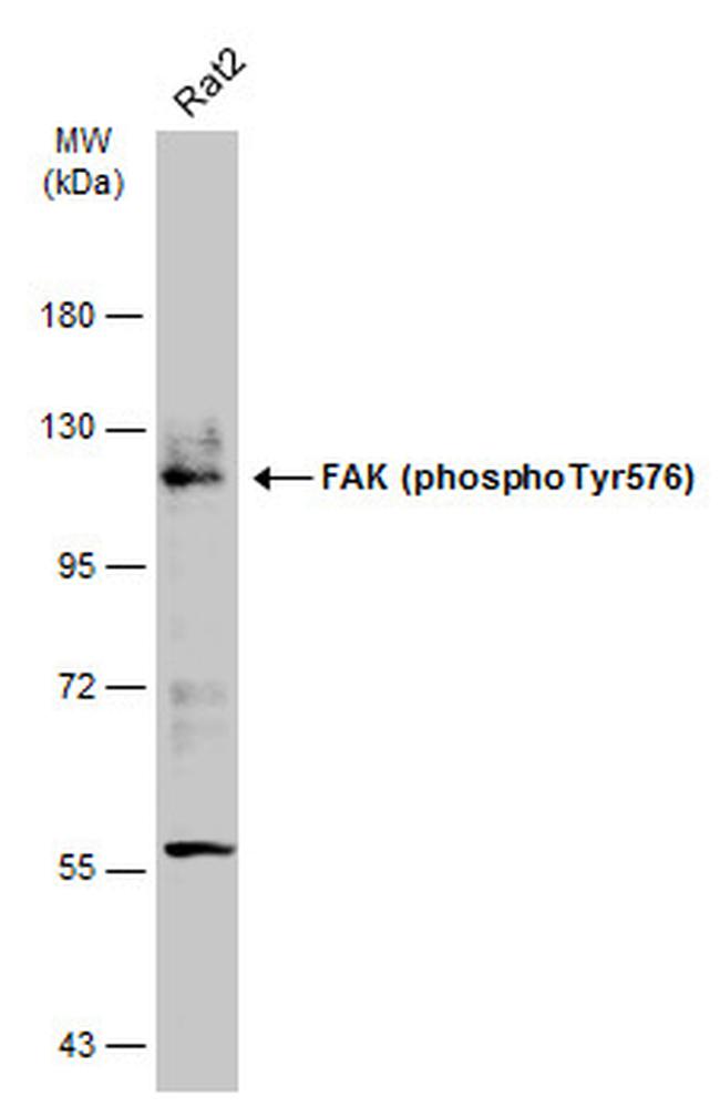 Phospho-FAK (Tyr576) Antibody in Western Blot (WB)