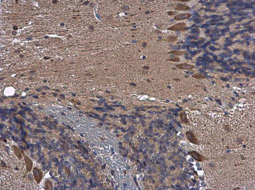 PTPN2 Antibody in Immunohistochemistry (Paraffin) (IHC (P))