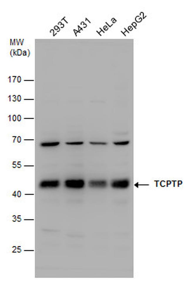 PTPN2 Antibody in Western Blot (WB)