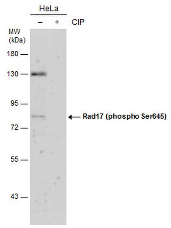 Phospho-RAD17 (Ser645) Antibody in Western Blot (WB)