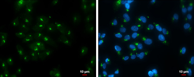 RAP1GAP Antibody in Immunocytochemistry (ICC/IF)