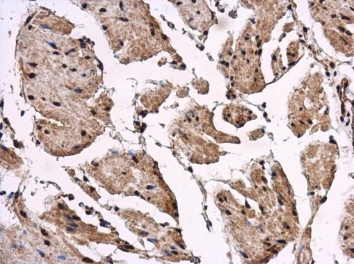 REST Antibody in Immunohistochemistry (Paraffin) (IHC (P))