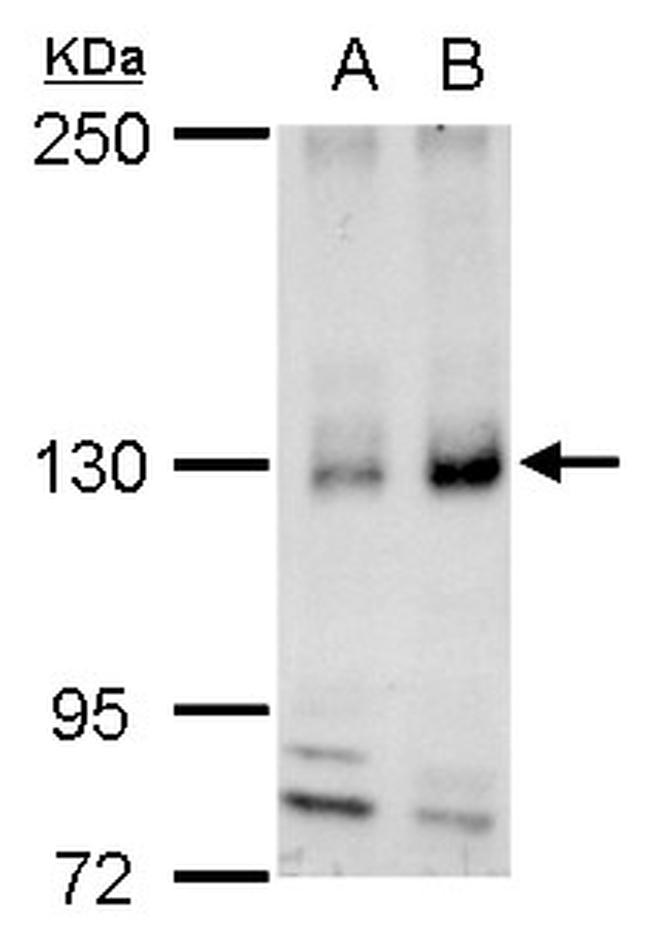 REST Antibody in Western Blot (WB)