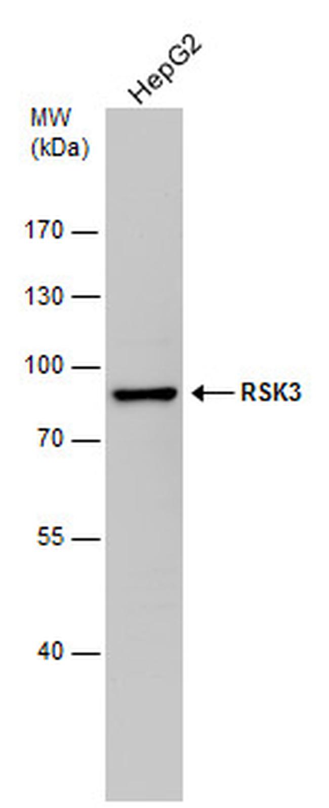 RSK3 Antibody in Western Blot (WB)