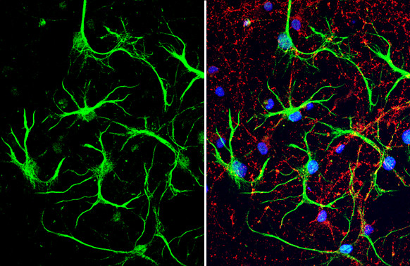 S100B Antibody in Immunocytochemistry (ICC/IF)